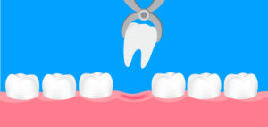 Manhattan Bridge Orthodontics Orthodontics tooth extraction