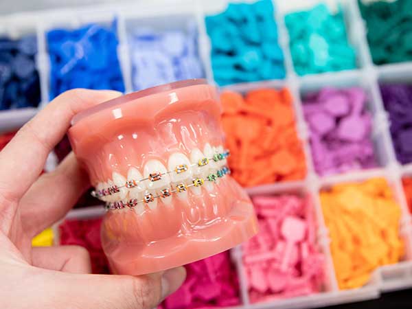 Manhattan Bridge Orthodontics Rainbow braces colors