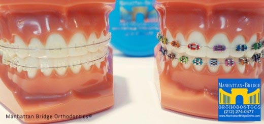 Phase 1 Interceptive Orthodontic Treatment | Manhattan Bridge Orthodontics