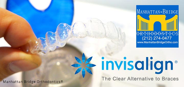 Invisalign Treatment Process Manhattan Bridge Orthodontics 