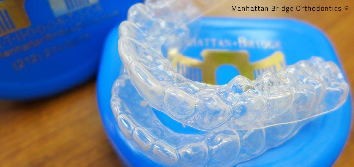 Retainers Manhattan Bridge Orthodontics